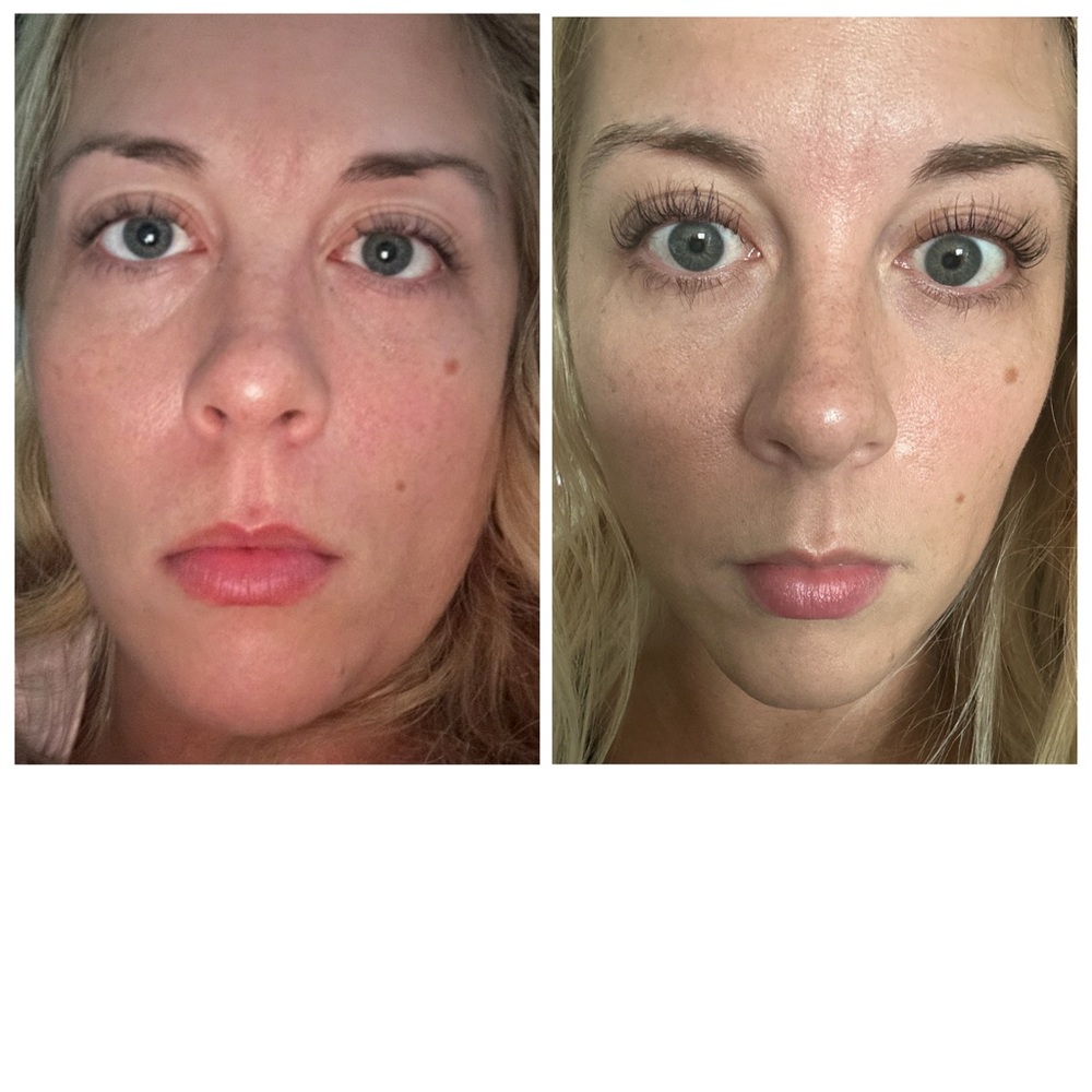 Eyelash Lengthening Serum (with my before & after photos) - Picture 1 of 4